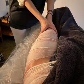 celulitis_centro_medico_estetico_tudela